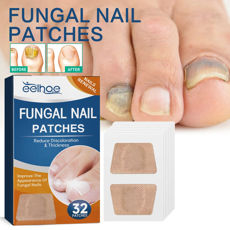 Pack de 64 Patchs régénérants antifongiques pour ongles - Stop mycose