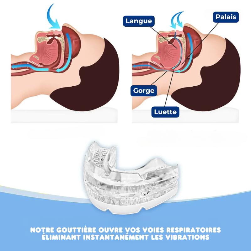 SILENCE SLEEP - Gouttière Anti-Ronflements & Anti-Apnée