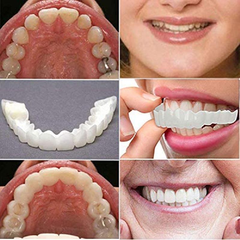 Facettes dentaires artificielles