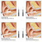 Caméra Otoscope HD - Micro USB, USB,  USB Type-C