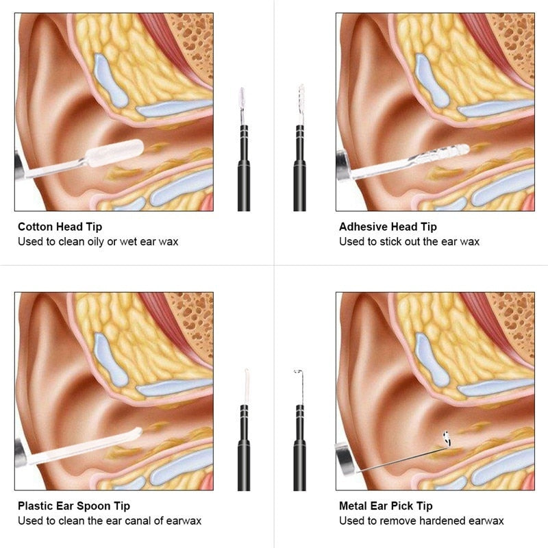 Caméra Otoscope HD - Micro USB, USB,  USB Type-C