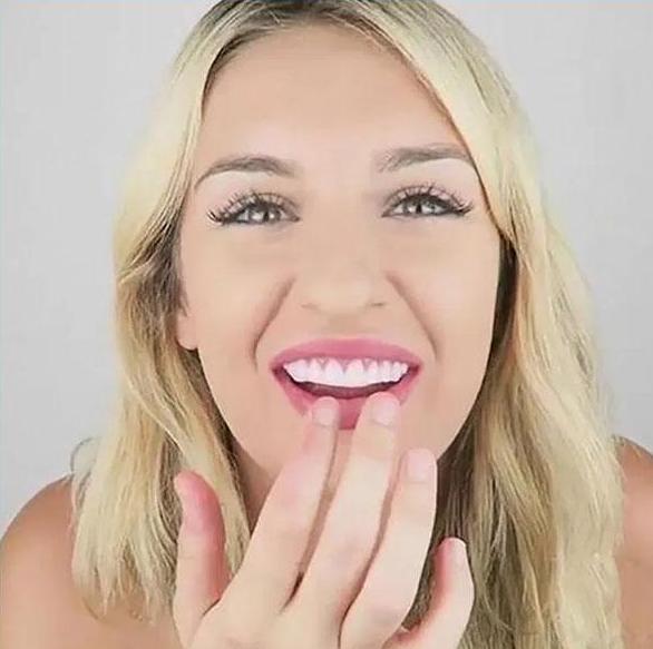 Facettes dentaires artificielles